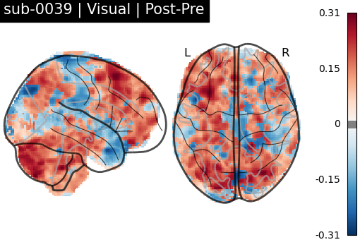 sub-0039_Visual_diff-comparison.png