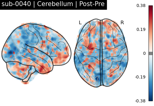sub-0040_Cerebellum_diff-comparison.png