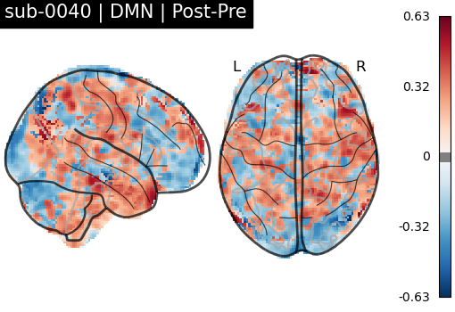 sub-0040_DMN_diff-comparison.png