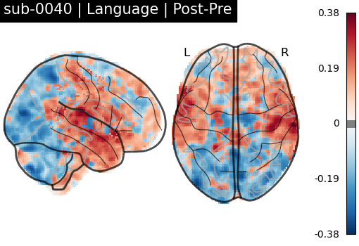 sub-0040_Language_diff-comparison.png