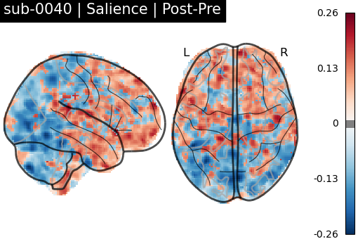 sub-0040_Salience_diff-comparison.png