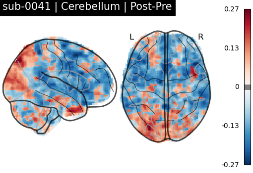 sub-0041_Cerebellum_diff-comparison.png