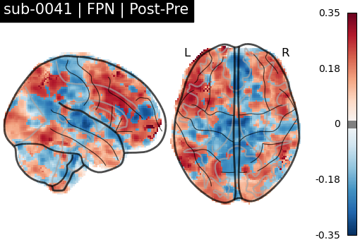 sub-0041_FPN_diff-comparison.png