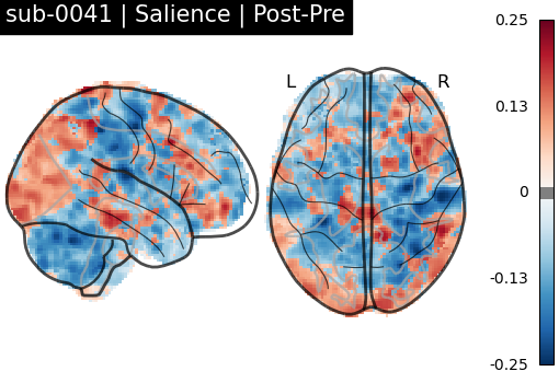 sub-0041_Salience_diff-comparison.png