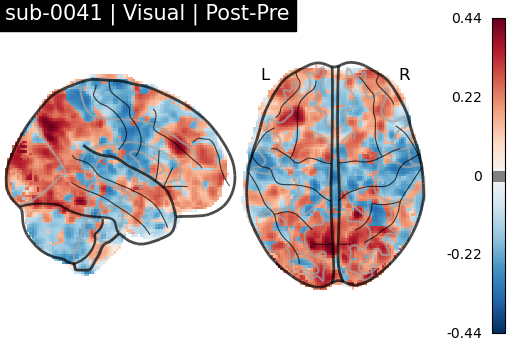 sub-0041_Visual_diff-comparison.png