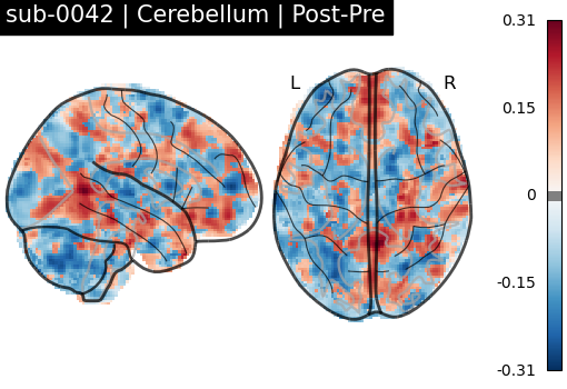 sub-0042_Cerebellum_diff-comparison.png