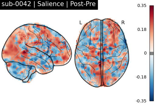 sub-0042_Salience_diff-comparison.png