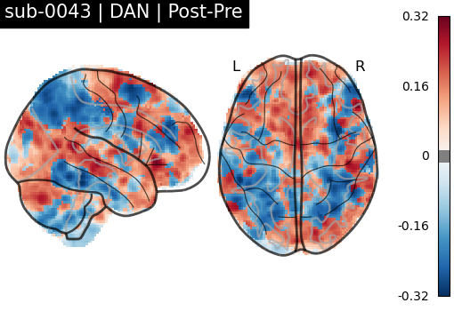 sub-0043_DAN_diff-comparison.png