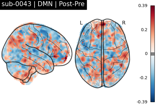 sub-0043_DMN_diff-comparison.png