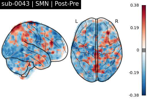 sub-0043_SMN_diff-comparison.png