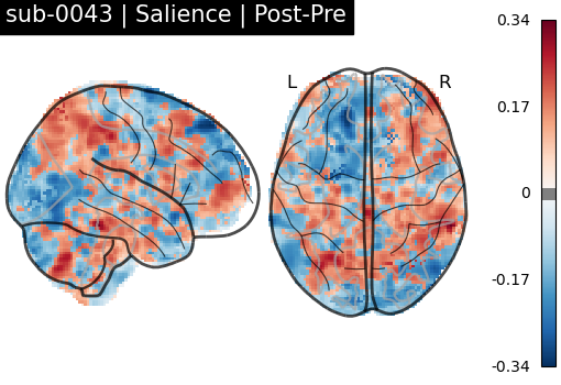 sub-0043_Salience_diff-comparison.png