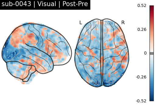 sub-0043_Visual_diff-comparison.png