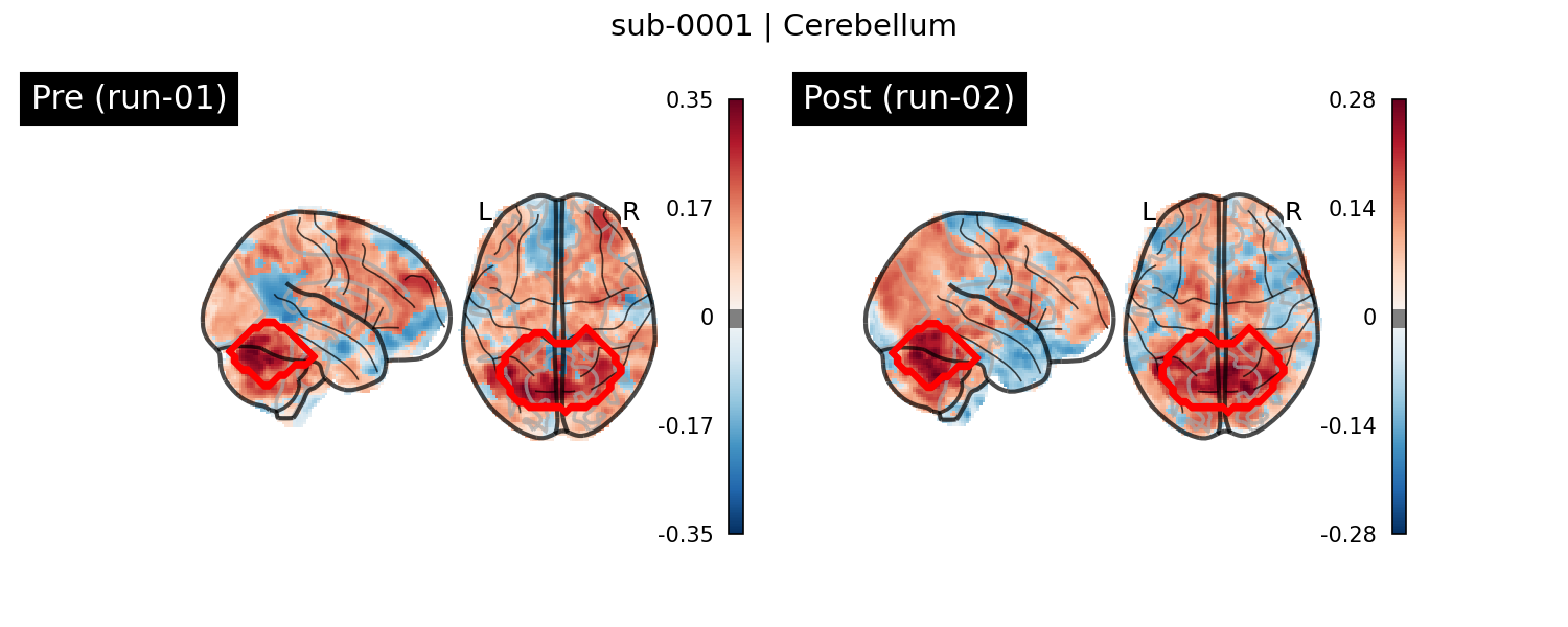 sub-0001_Cerebellum_run-comparison.png