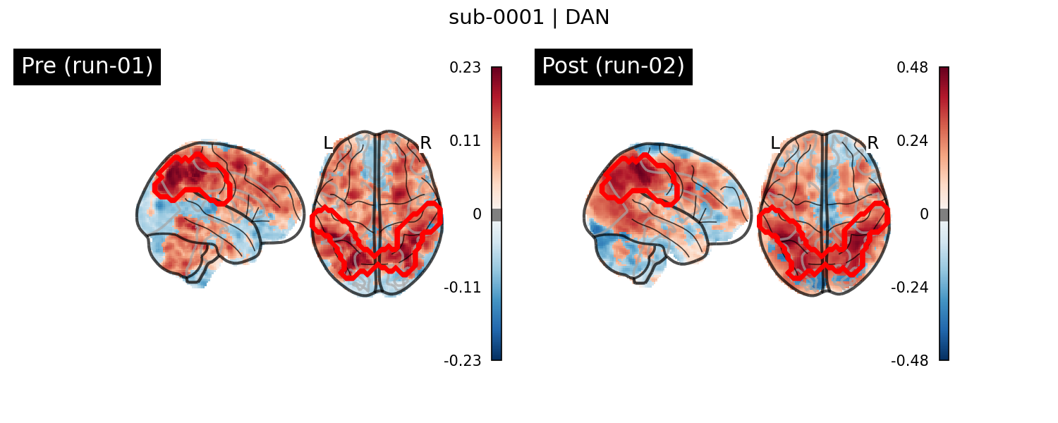 sub-0001_DAN_run-comparison.png