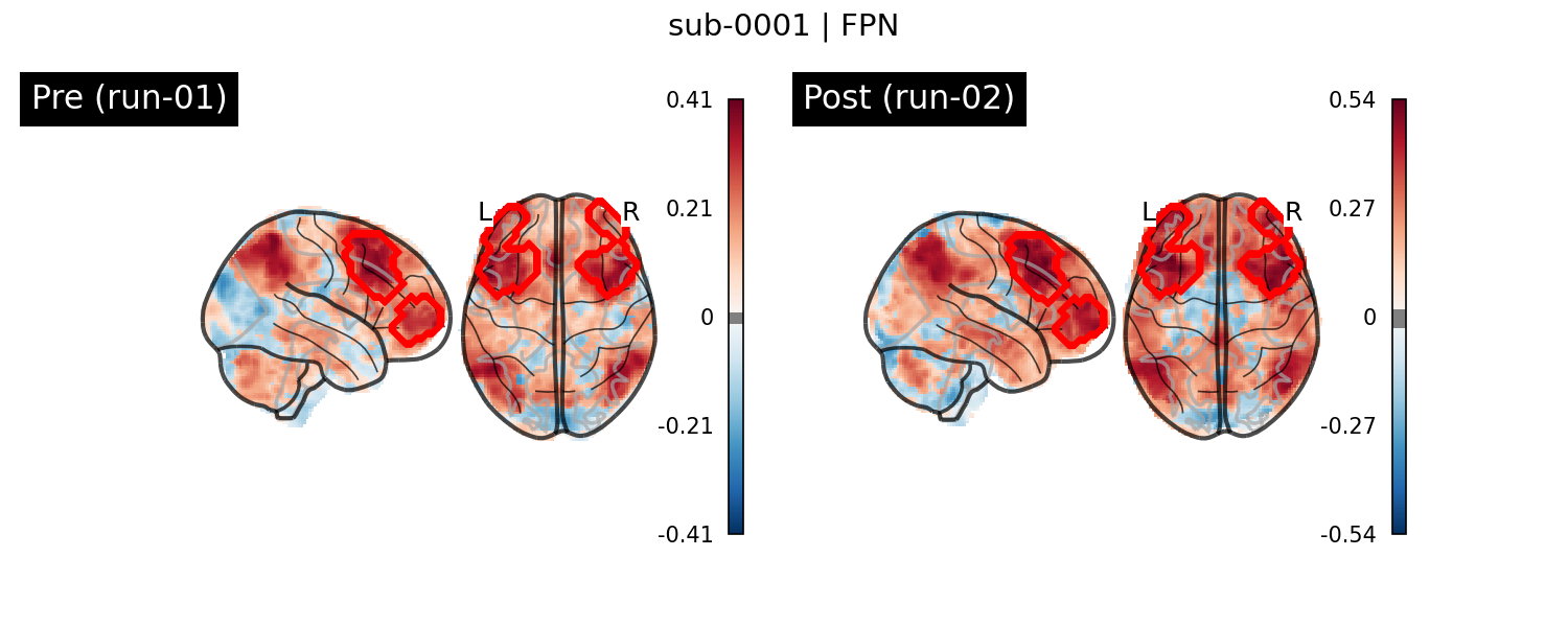 sub-0001_FPN_run-comparison.png