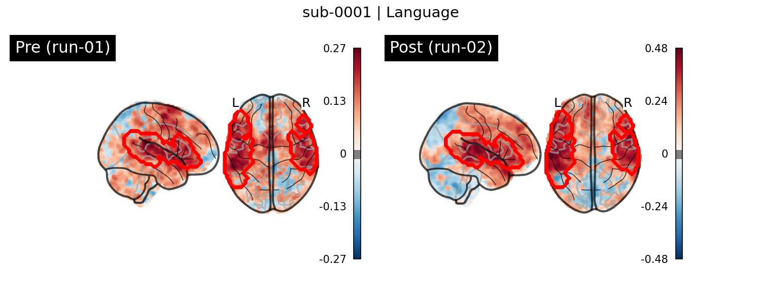 sub-0001_Language_run-comparison.png