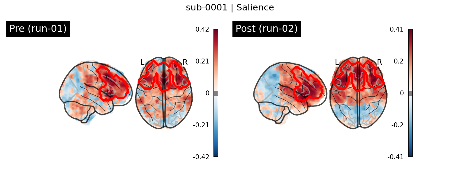 sub-0001_Salience_run-comparison.png