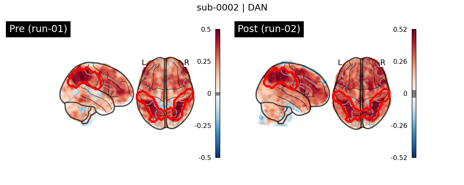 sub-0002_DAN_run-comparison.png