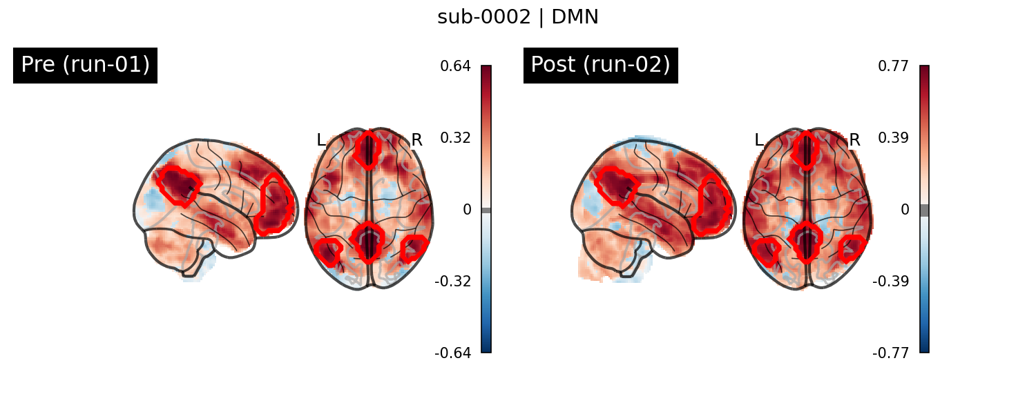 sub-0002_DMN_run-comparison.png
