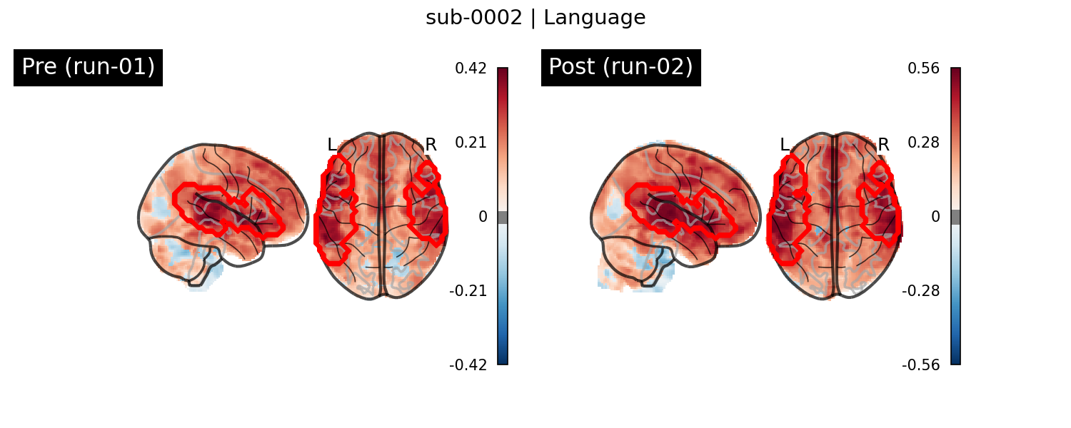 sub-0002_Language_run-comparison.png