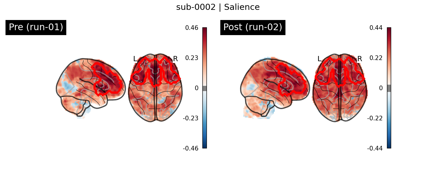 sub-0002_Salience_run-comparison.png