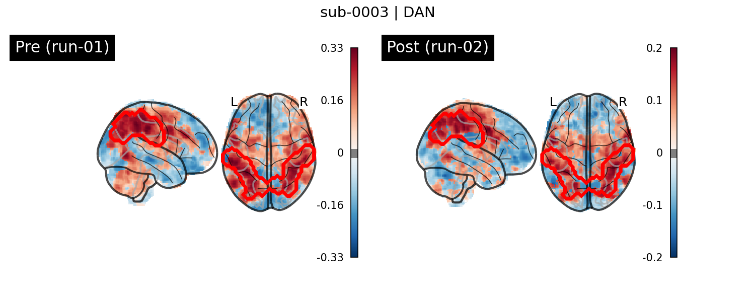 sub-0003_DAN_run-comparison.png