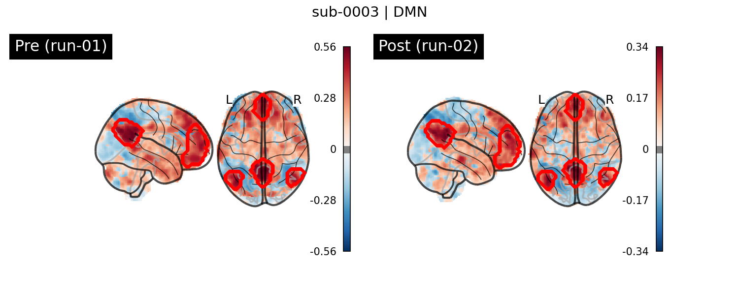 sub-0003_DMN_run-comparison.png