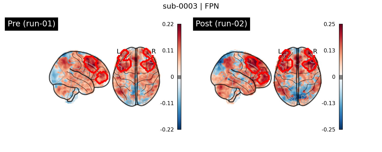 sub-0003_FPN_run-comparison.png