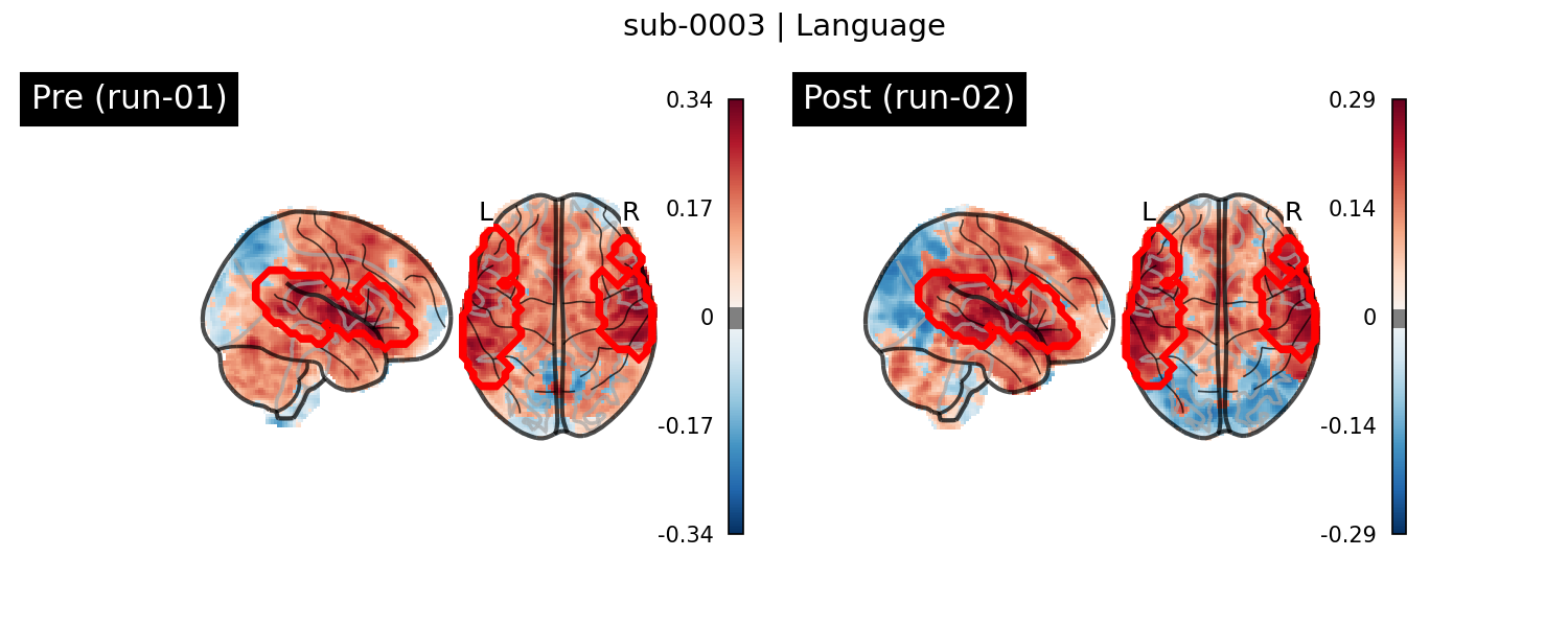 sub-0003_Language_run-comparison.png