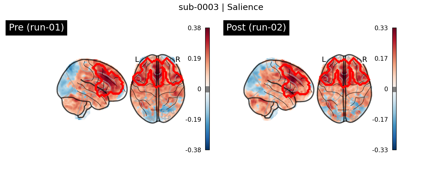 sub-0003_Salience_run-comparison.png