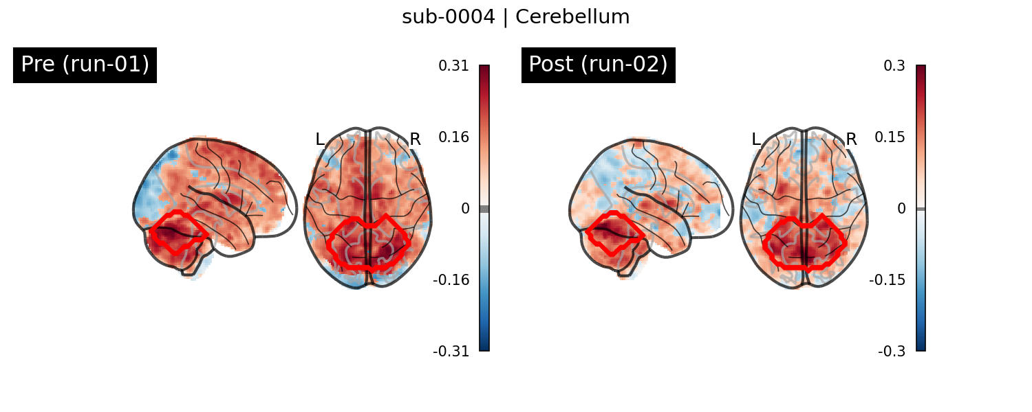 sub-0004_Cerebellum_run-comparison.png