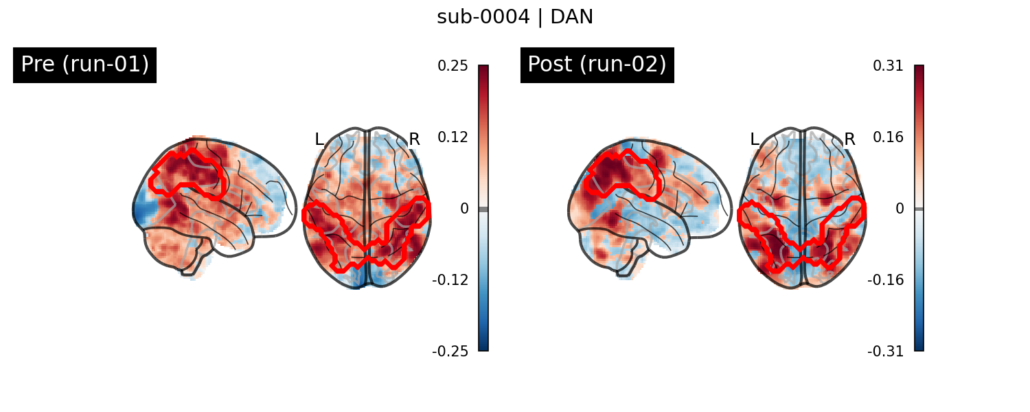 sub-0004_DAN_run-comparison.png