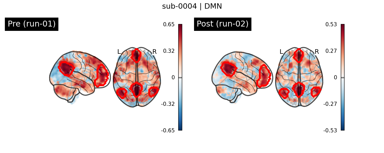 sub-0004_DMN_run-comparison.png