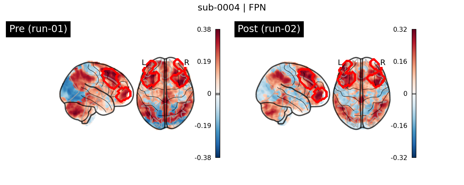 sub-0004_FPN_run-comparison.png