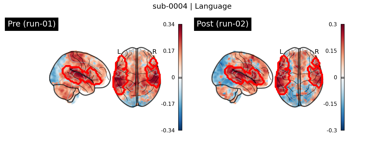 sub-0004_Language_run-comparison.png
