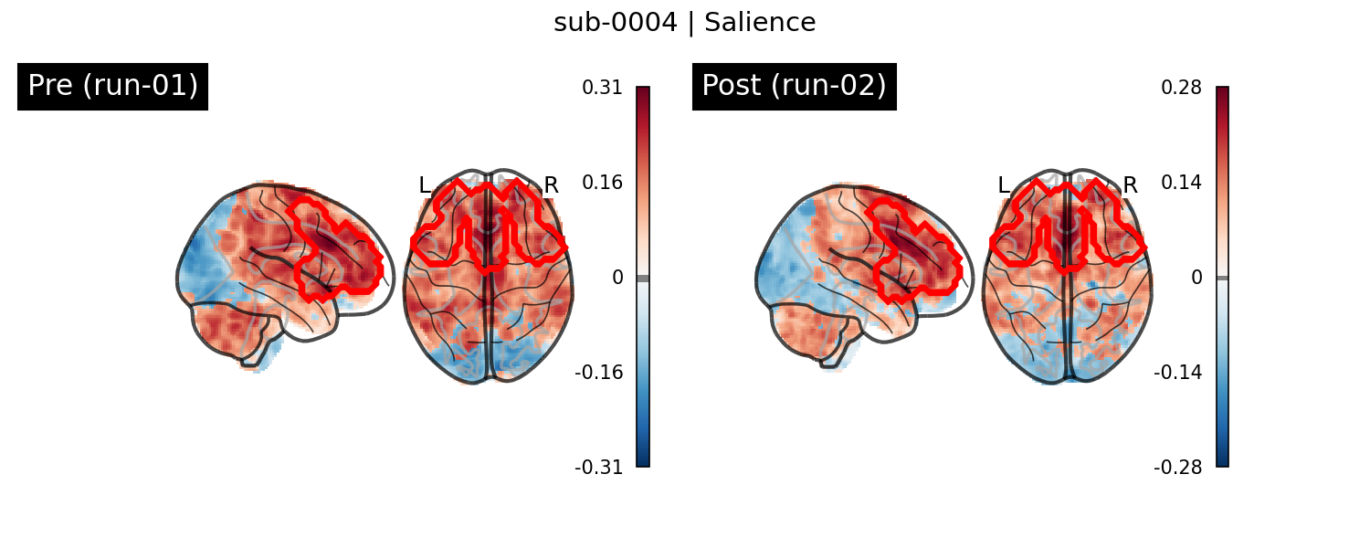 sub-0004_Salience_run-comparison.png