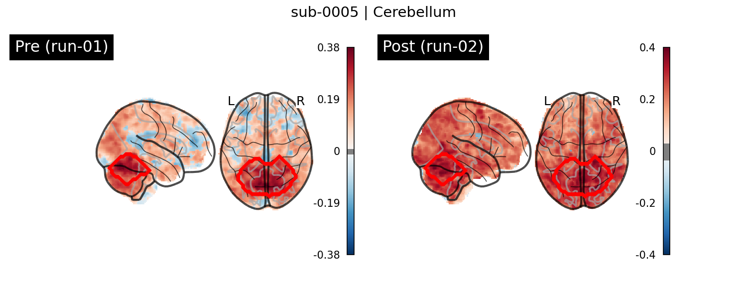 sub-0005_Cerebellum_run-comparison.png