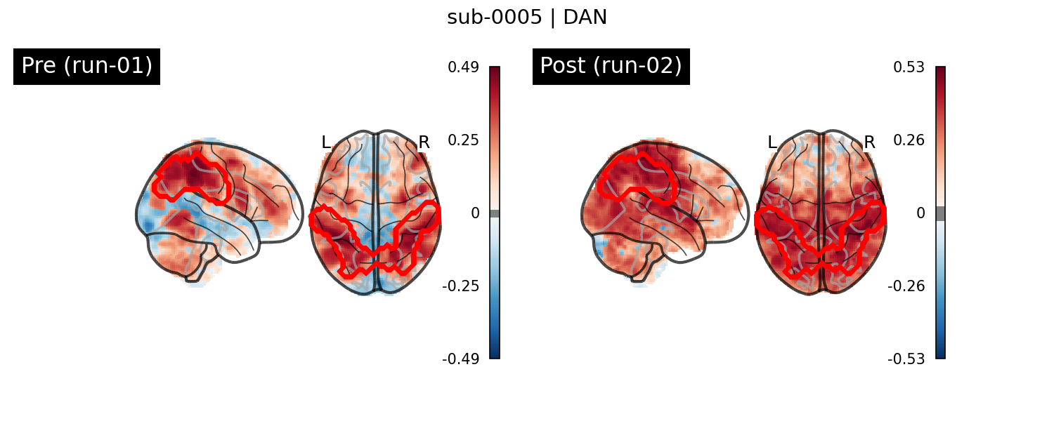 sub-0005_DAN_run-comparison.png