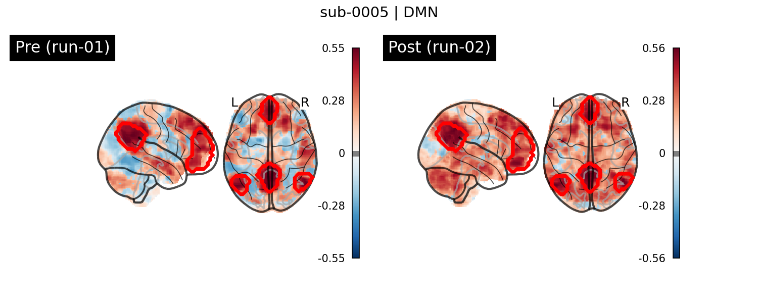 sub-0005_DMN_run-comparison.png