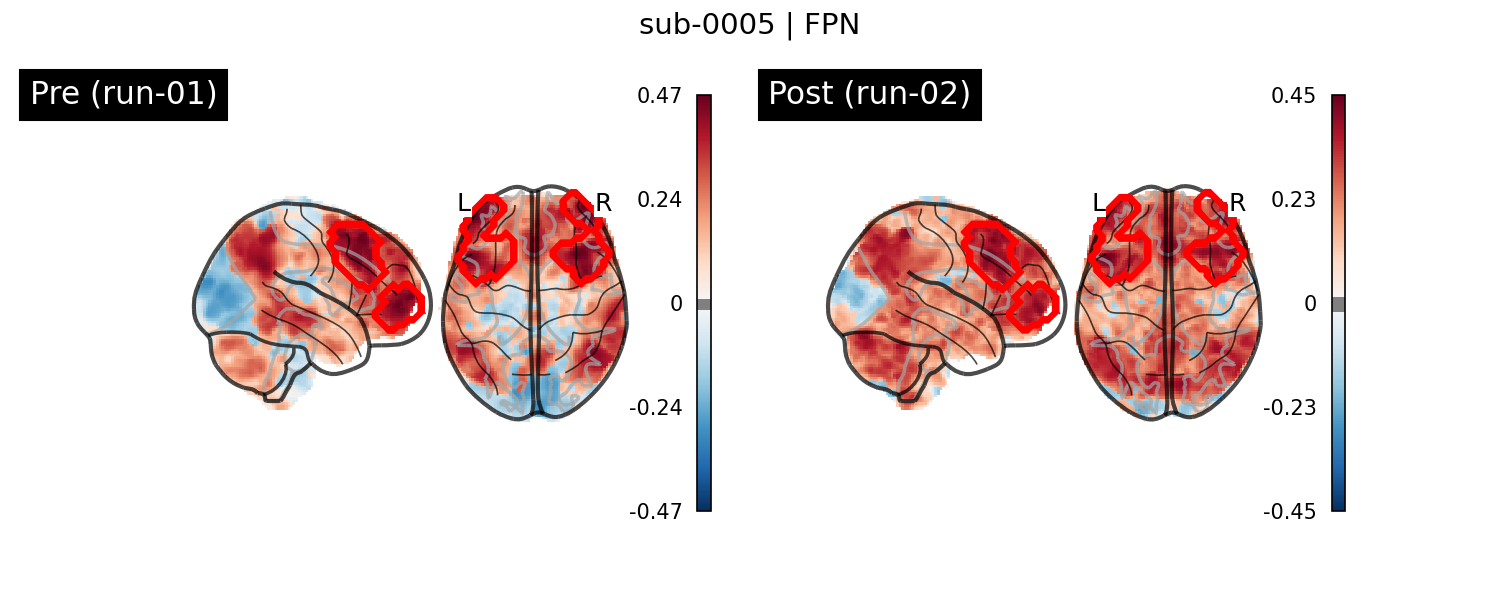 sub-0005_FPN_run-comparison.png