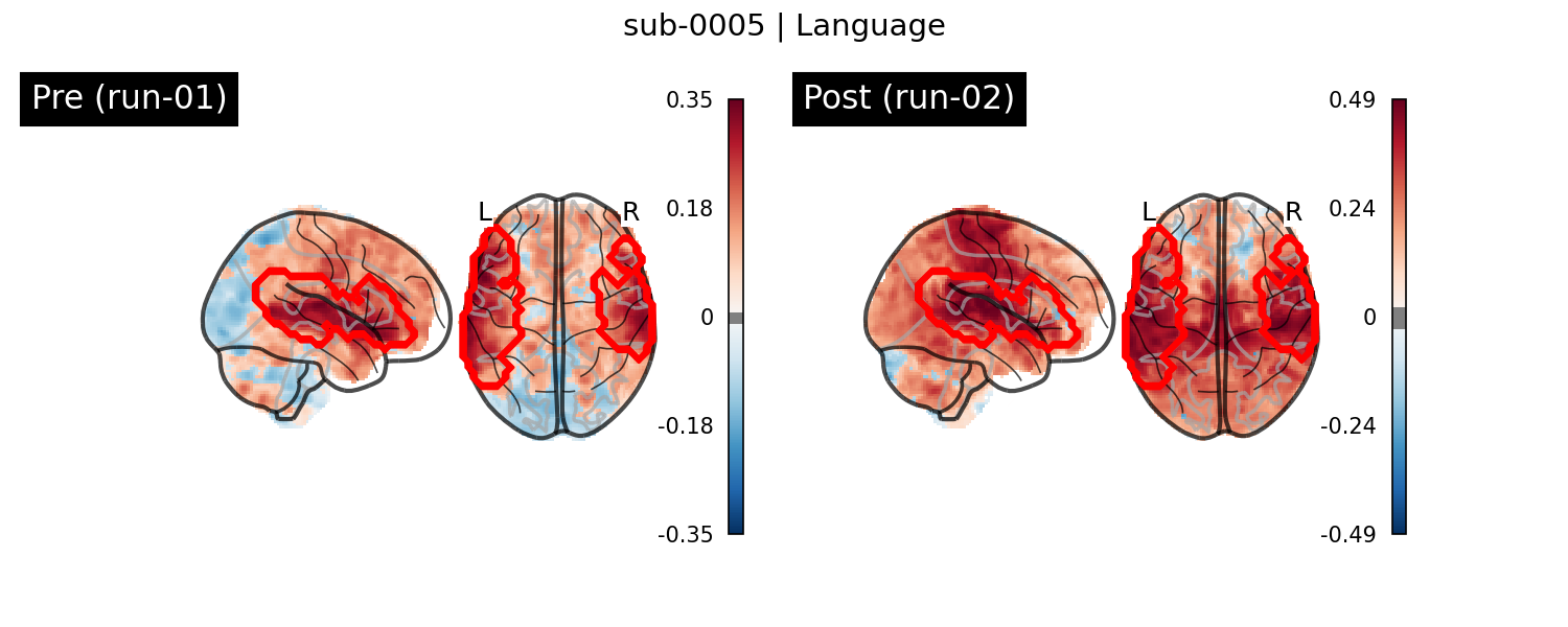 sub-0005_Language_run-comparison.png