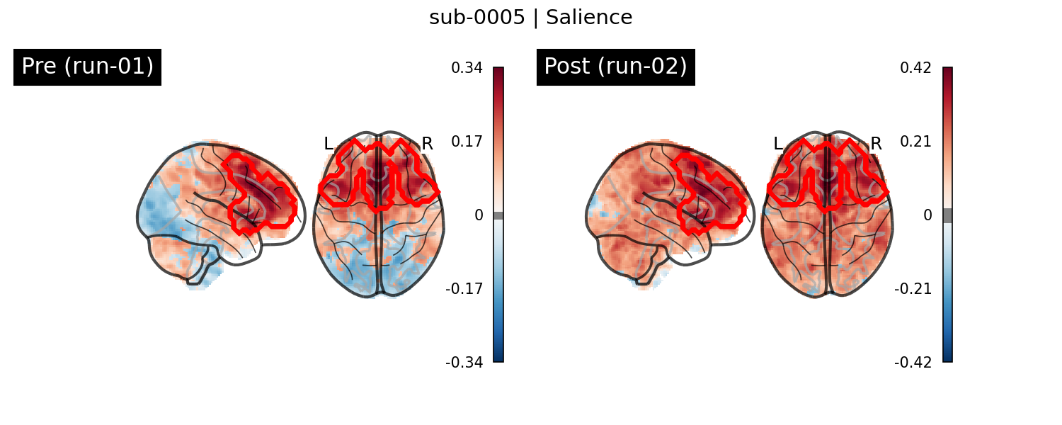 sub-0005_Salience_run-comparison.png
