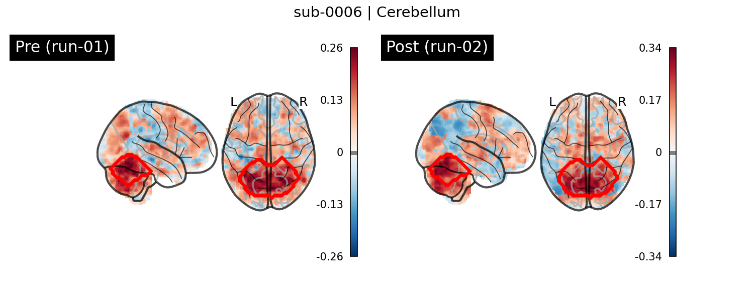 sub-0006_Cerebellum_run-comparison.png