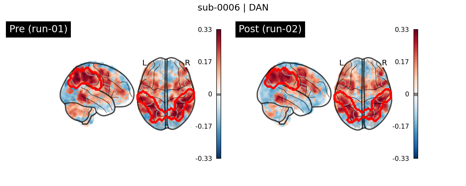 sub-0006_DAN_run-comparison.png