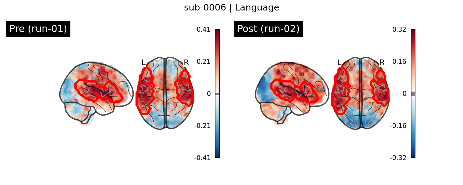 sub-0006_Language_run-comparison.png