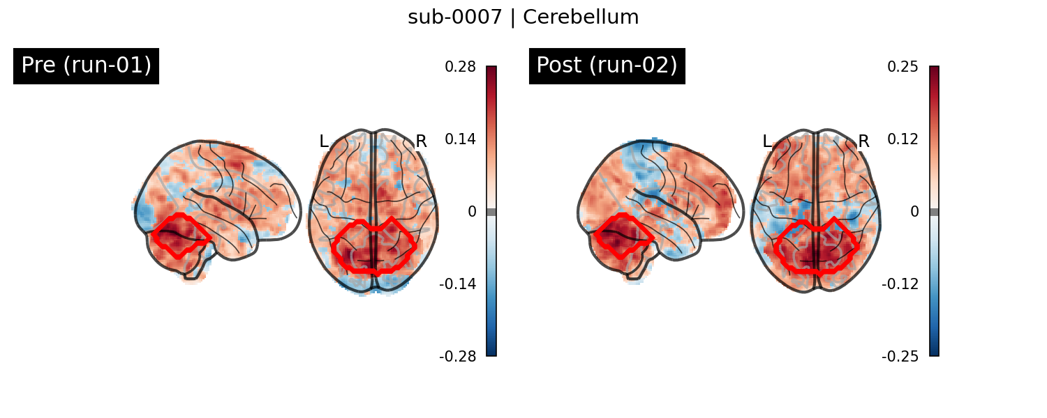 sub-0007_Cerebellum_run-comparison.png