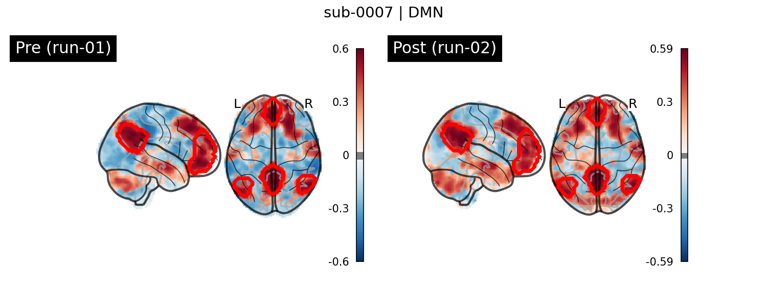 sub-0007_DMN_run-comparison.png