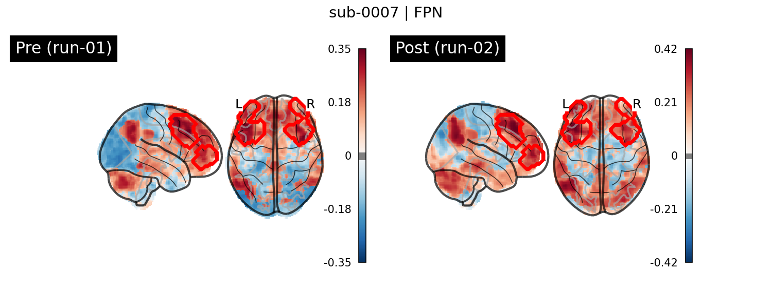 sub-0007_FPN_run-comparison.png