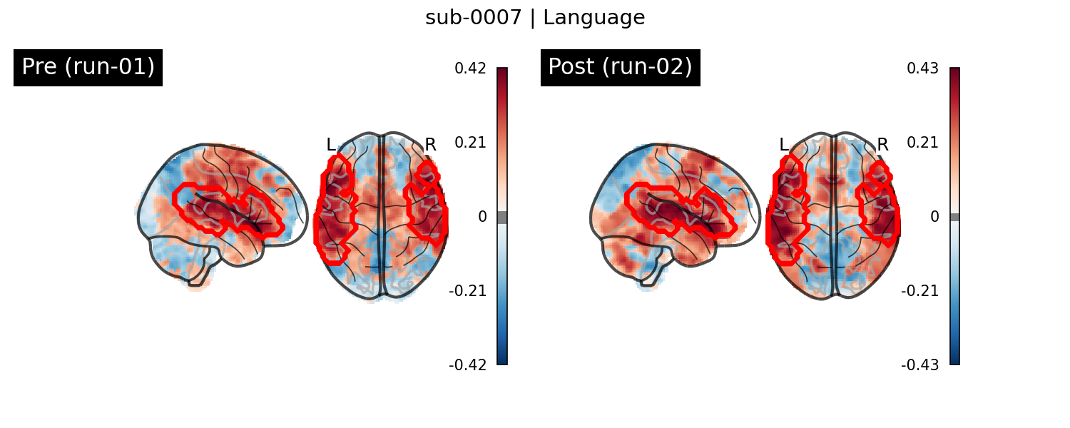 sub-0007_Language_run-comparison.png