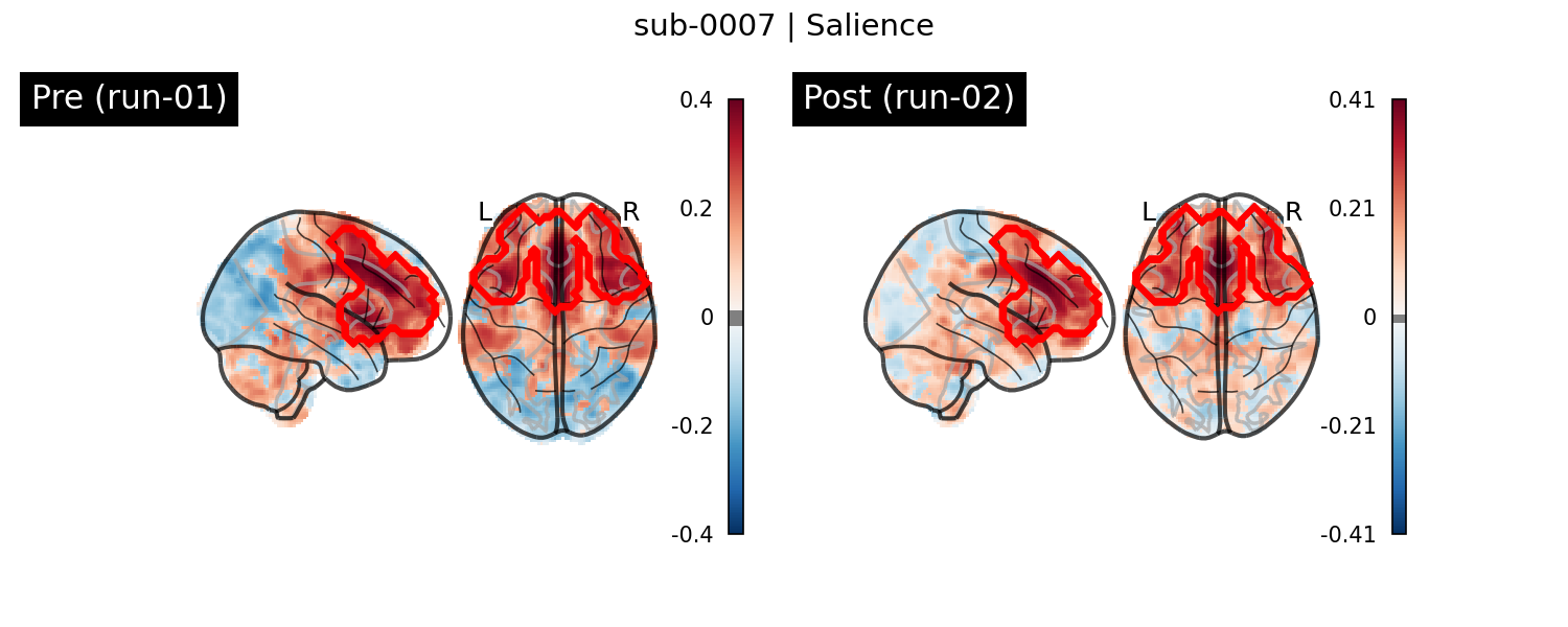 sub-0007_Salience_run-comparison.png